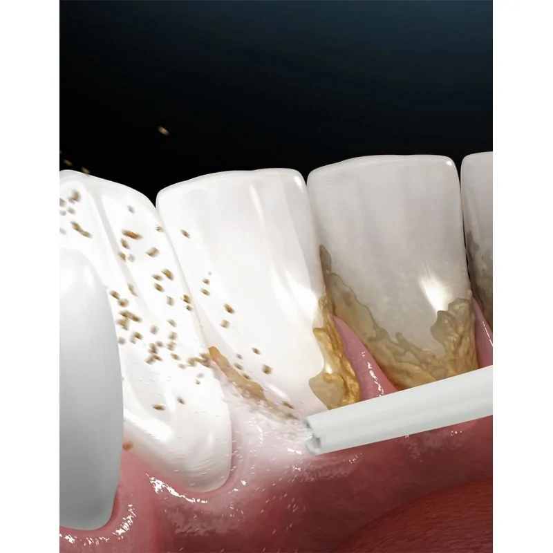 Lanaform Nettoyant dentaire Hydrojet – Image 2