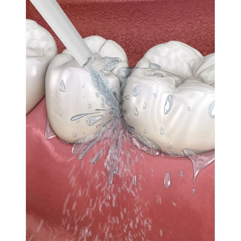 Lanaform Nettoyant dentaire Hydrojet – Image 3
